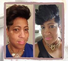 woman with vitiligo #BeautifulBothWaysCampaign