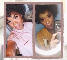 woman with vitiligo #BeautifulBothWaysCampaign