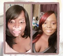 woman with vitiligo #BeautifulBothWaysCampaign