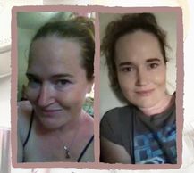 woman with vitiligo #BeautifulBothWaysCampaign