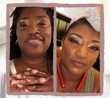 woman with vitiligo #BeautifulBothWaysCampaign