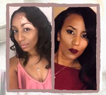 woman with vitiligo #BeautifulBothWaysCampaign