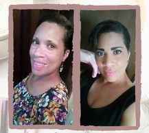 woman with vitiligo #BeautifulBothWaysCampaign