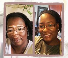 woman with vitiligo #BeautifulBothWaysCampaign