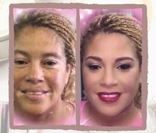 woman with vitiligo #BeautifulBothWaysCampaign