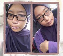 woman with vitiligo #BeautifulBothWaysCampaign