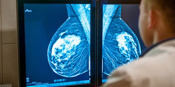 Radiologist examining mammogram