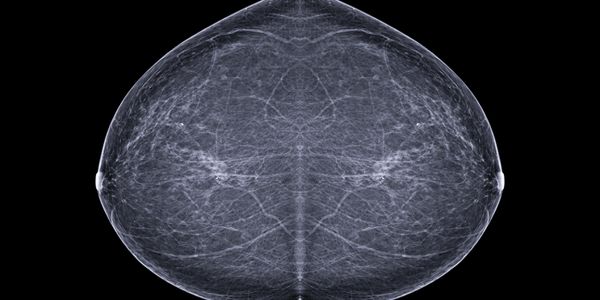 mammogram both sides