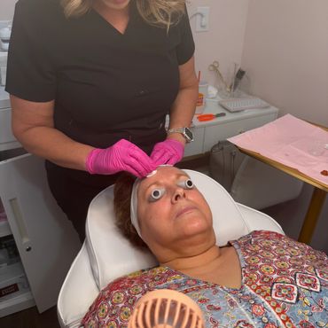 Chemical Peel Administration