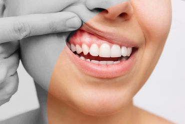 United Dental Dentistry North York