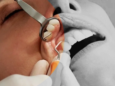 Dental Care For All ages Checking up