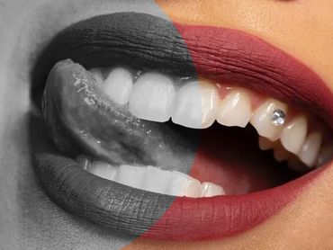 Cosmetic Dentistry Clinic in Nort York Toronto