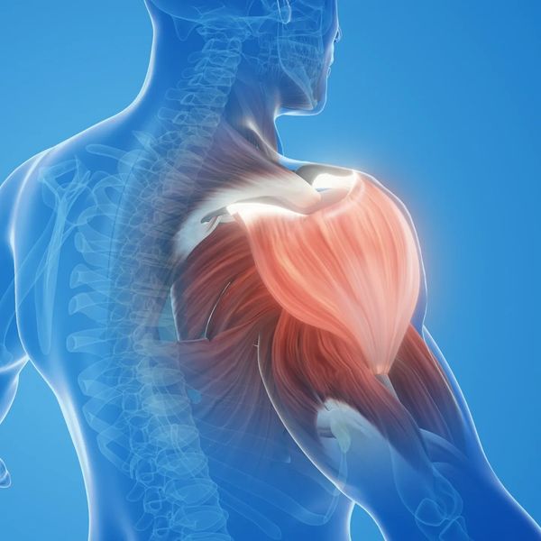 Frozen shoulder treatment and restricted movement therapy in Chingford and Waltham Forest