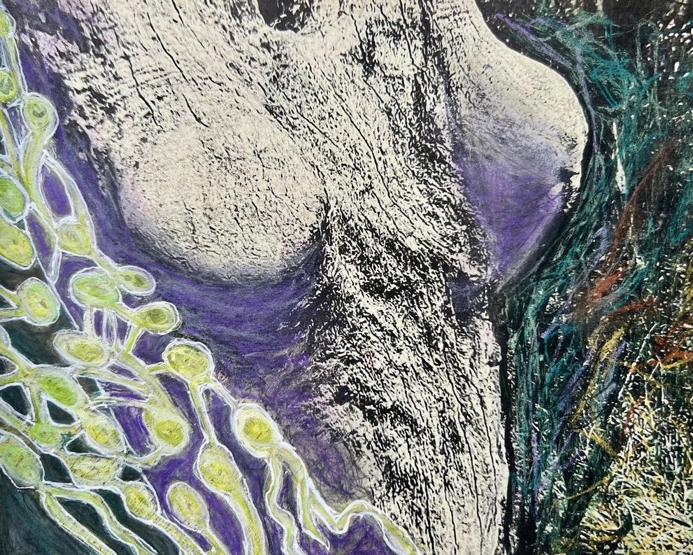 Ode to the Node Multimedia Collage for Lymphedema awareness and art therapy