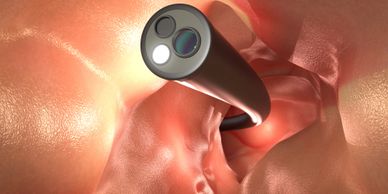 Colonoscopy facility available at Sree Gastro and Liver Clinic, Dwarka, Delhi by Gastroenterologist