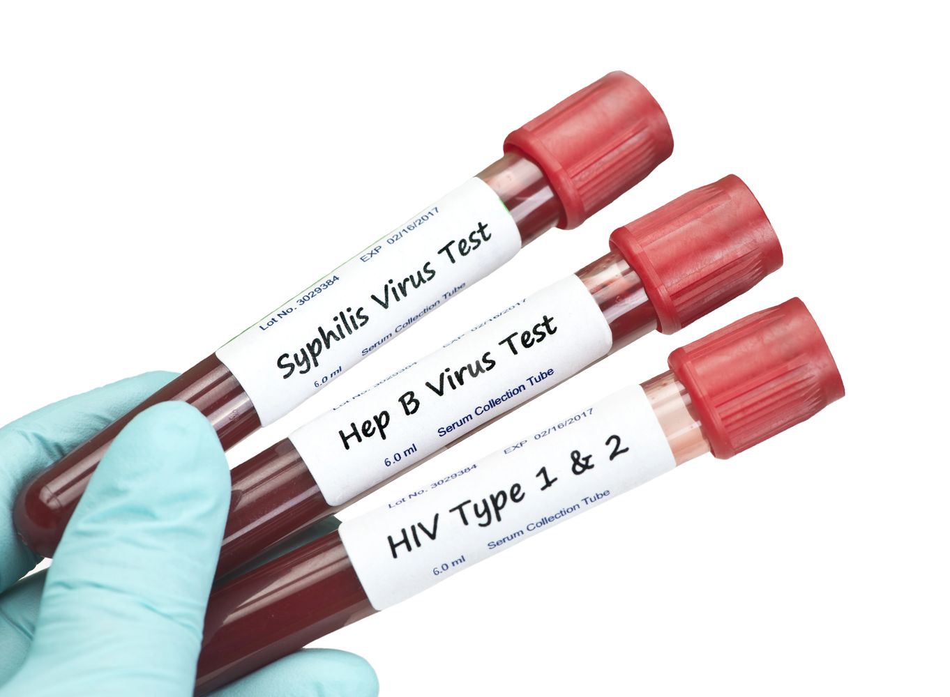 STD TESTING