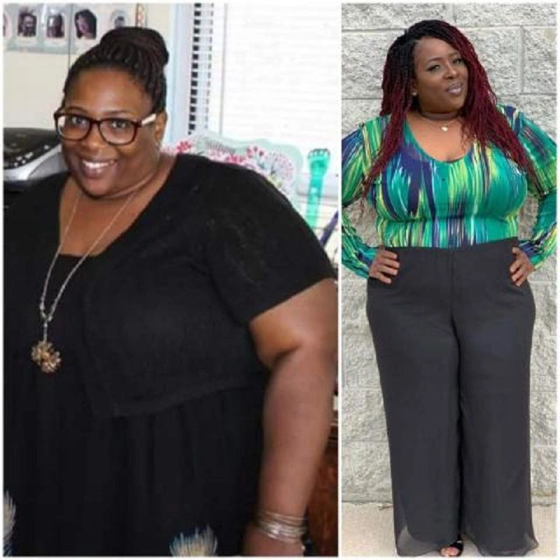 Before and after weight loss transformation of a smiling woman.