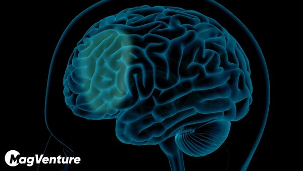 Dorsolateral prefrontal cortex (DLPFC)
