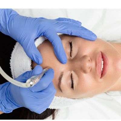 A patient receiving microdermabrasion facial treatment. 
