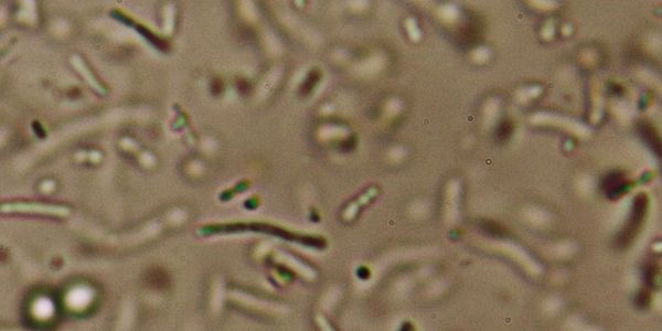 Lactic Acid Bacteria