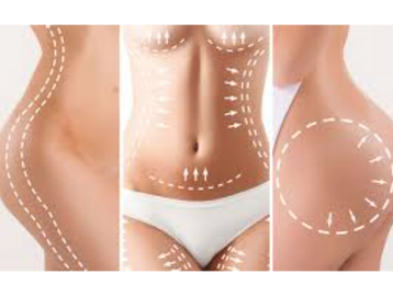 Changing the shape of the body