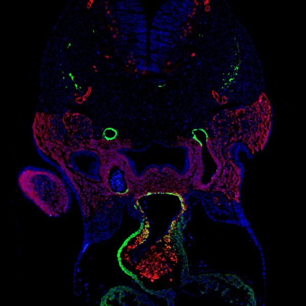 Cardiac outflow tract from E11.5 mouse embryo.