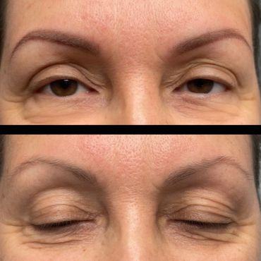 Close-up of eyes showing eyebrow transformation with makeup or microblading.
