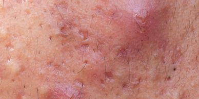 mixed spots on skin