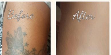 before and after photo - tattoo cover