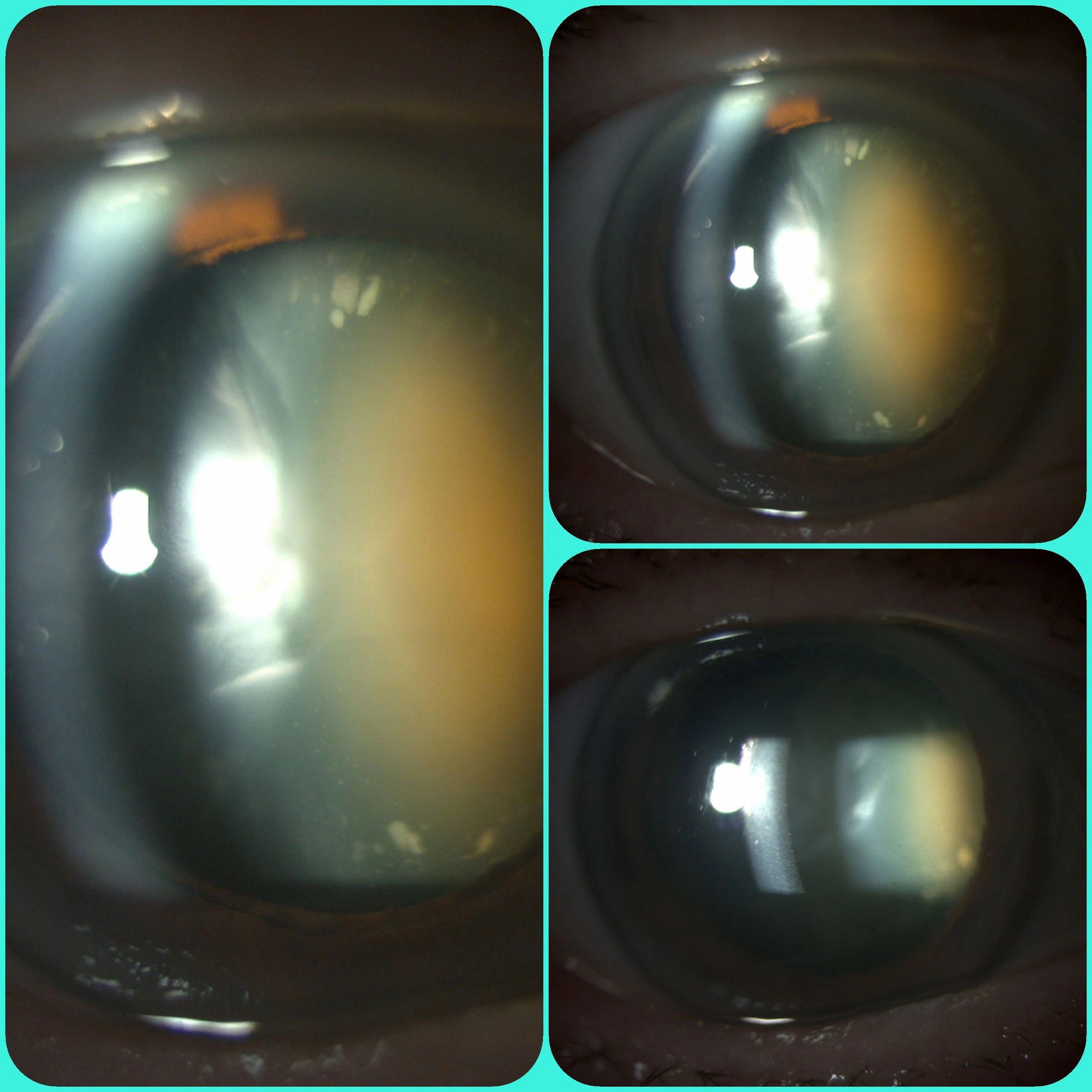 Cataract Surgeon
Eye surgeon
Mr patel