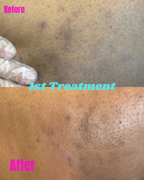 Visible results after just one session