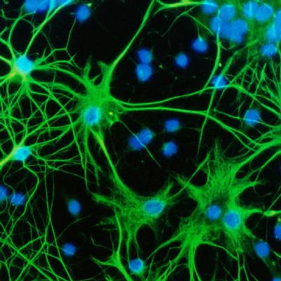 astrocytes
neurofeedback in Sebastopol