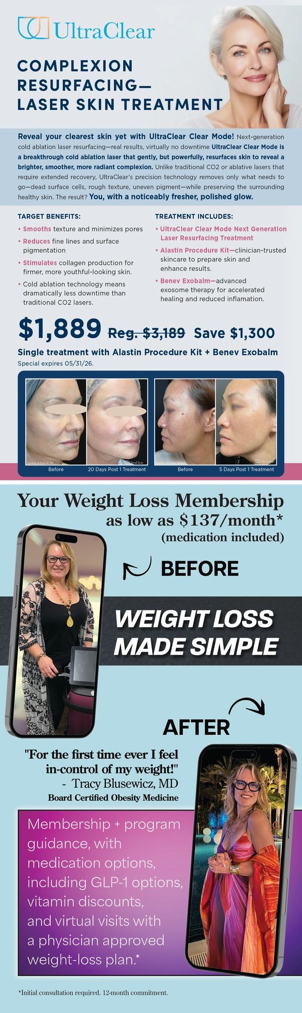 Aspire Medical Spa Ultra Clear May Promotion with before and after photos