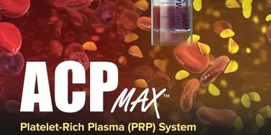 ACP MAX Platelet-Rich Plasma system by Arthrex held by gloved hands.