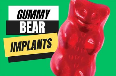 gummy bear implants