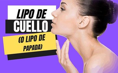 liposucción de cuello en Sonora lipopapada lipo de cuello