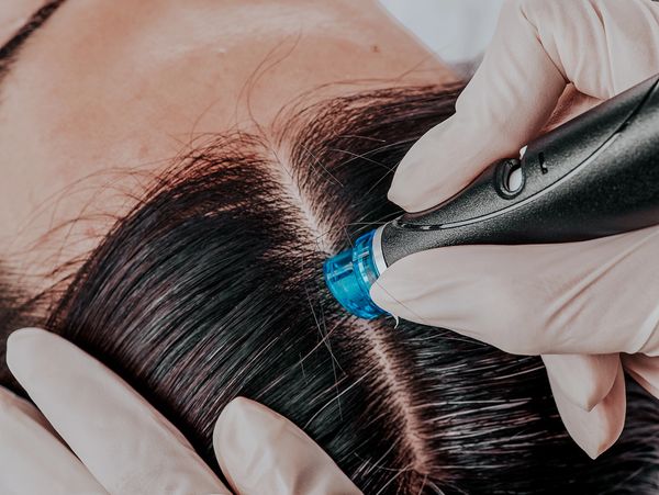 Hydrafacial treatment on brunette haired woman
