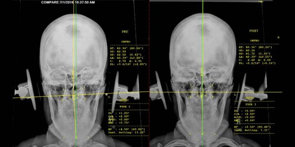 Chiropractor in Tampa