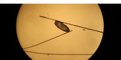 horse louse egg under the microscope