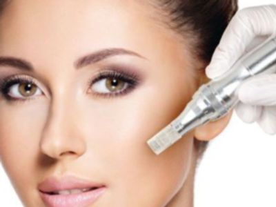How Microneedling works