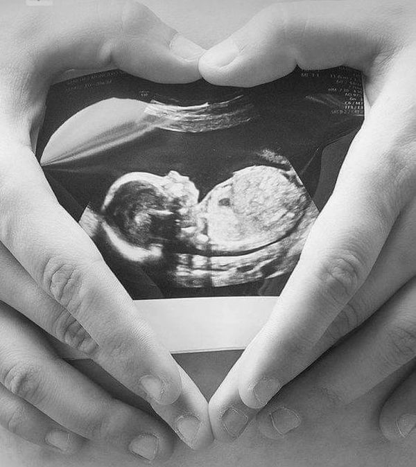 Hands in a heart shape around an ultrasound photo