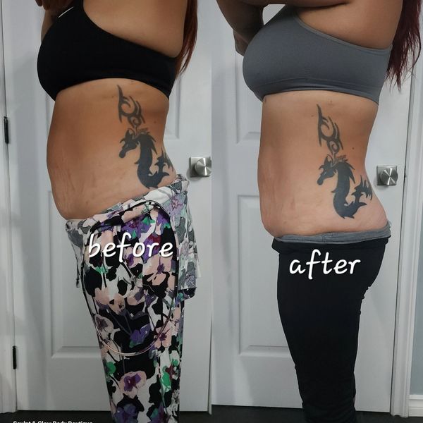 WAIST SLIMMING & SCULPTING PACAKGE