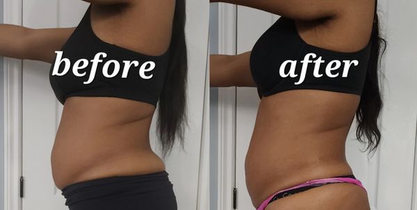 2 body sculpting seeions +1 virtual Mesotherapy session