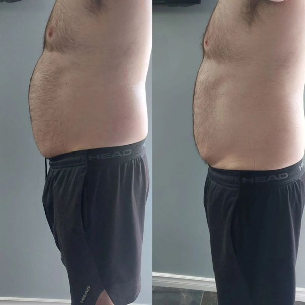 Waistslimming treatment