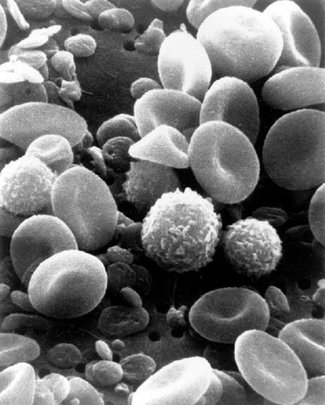 Red Blood Cells Scanning Electron Microscope Jeffrey Dach MD