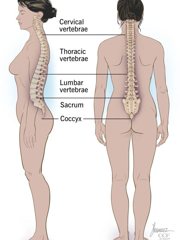 Shows a medical image of a woman’s spine location by Kanasz 2017