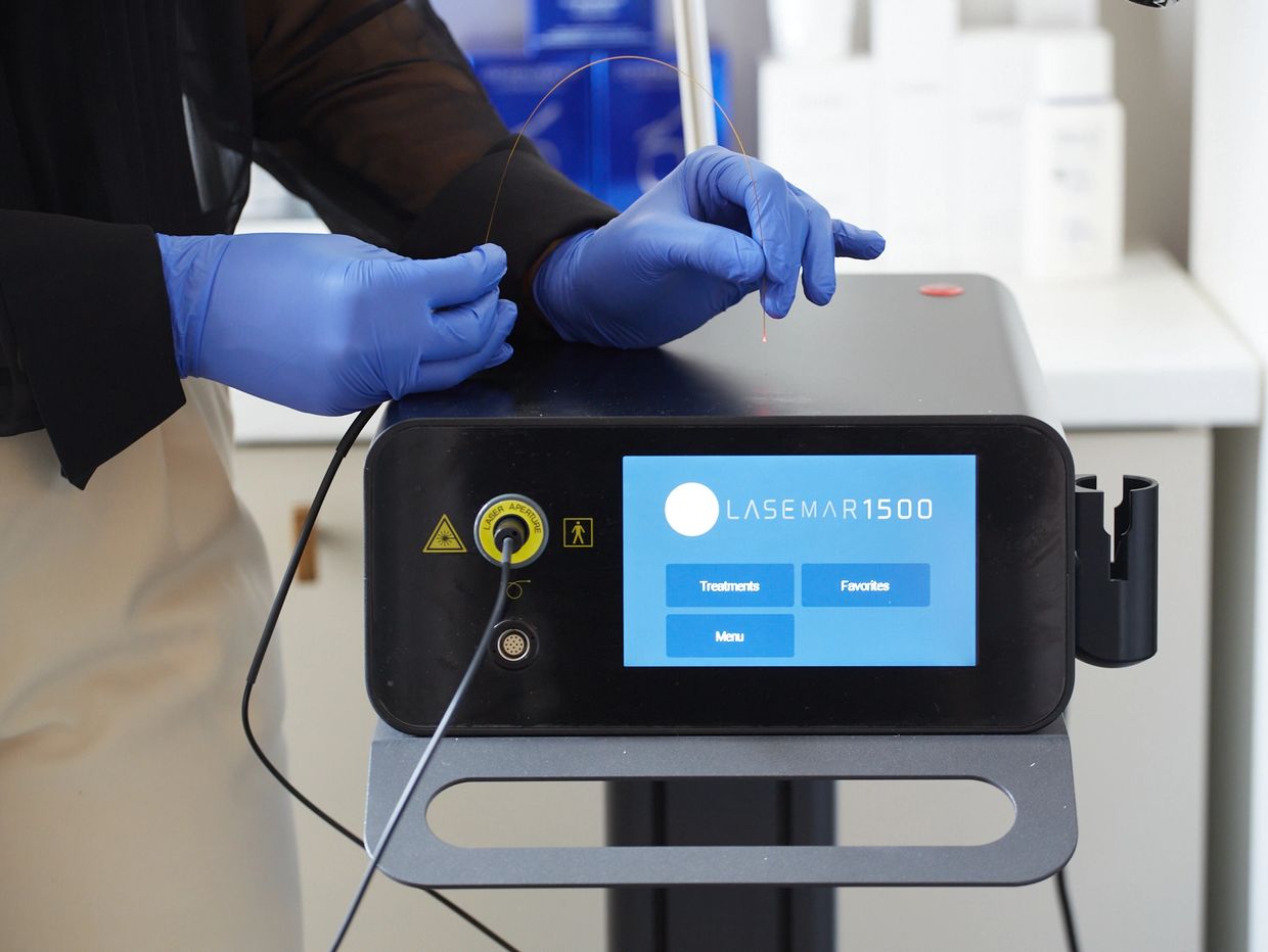 Hands in blue gloves handling a laser device labeled LASER 1500 Endolift