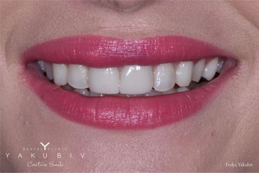 Yakubiv Dental