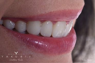 Yakubiv Dental