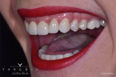 Yakubiv Dental